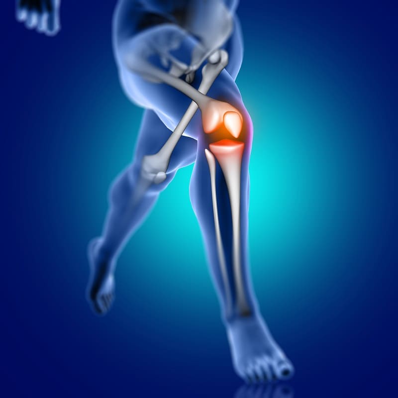 Prótesis de rodilla